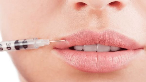 Якими препаратами збільшують губи?