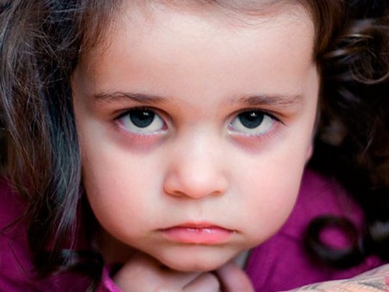 Синяки под глазами у ребенка — причин множество