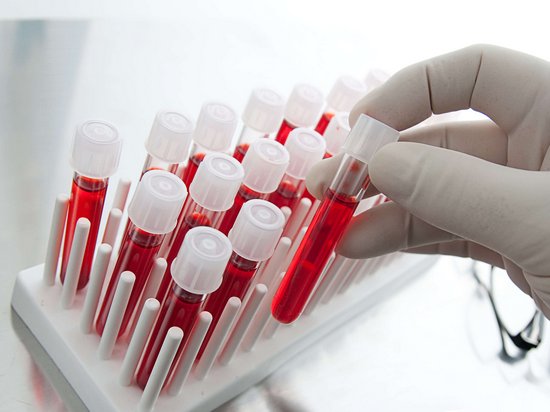 Анализ крови: виды исследований и преимущества проведения процедуры в клинике