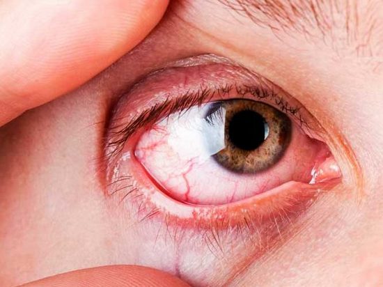 Причины заболевания глаз