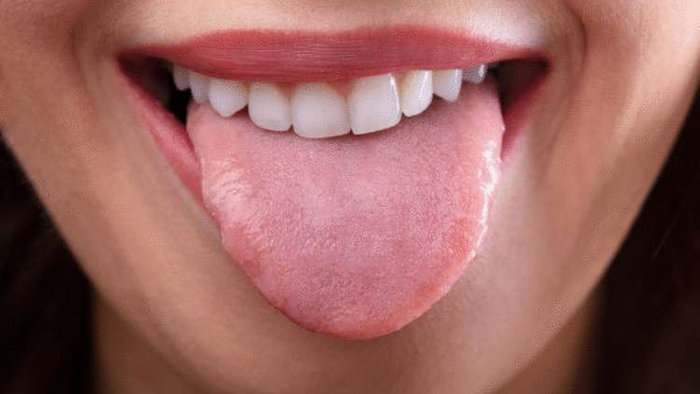 Когда следы зубов на языке – сигнал о проблемах со здоровьем?