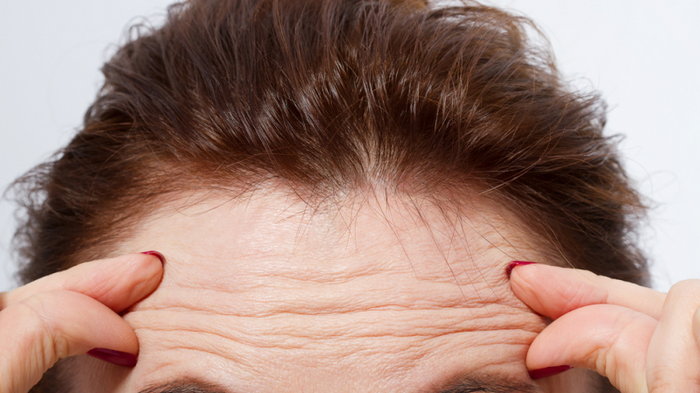 6 признаков того, что стресс влияет на вашу кожу лица