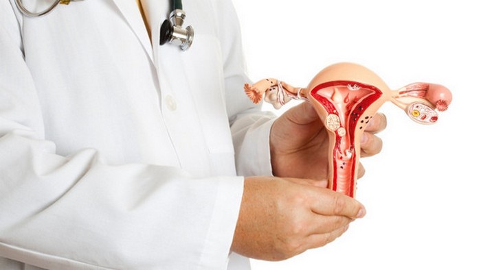 Что такое ретроцервикальный эндометриоз?