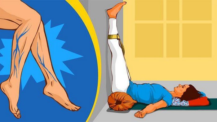 5 асан йоги, которые помогут избавиться от варикозного расширения вен