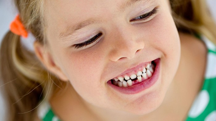 Кривые зубы у детей