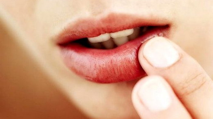 О чём говорят сухие раздраженные губы и как наконец-то избавиться от этого явления?
