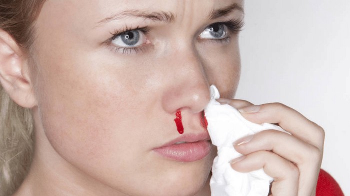 Носовое кровотечение – причины и способы остановки