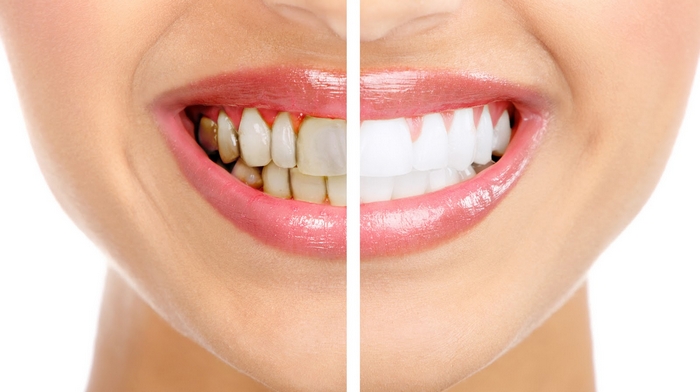 Что нужно знать об эстетической стоматологии