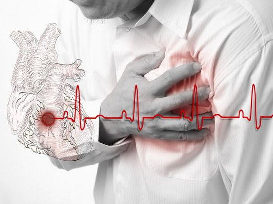 Признаки инфаркта у мужчин