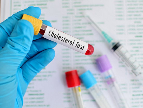 Нормальный холестерин — необходимый уровень содержания в организме