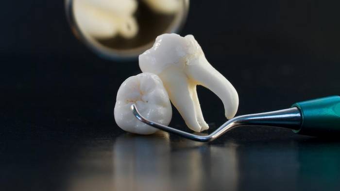 Зубной налет исчезнет спустя 5 минут