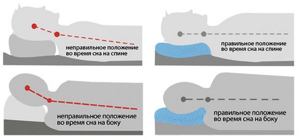 правильное положение сна