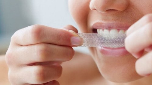 Отбеливать зубы в домашних условиях — легко