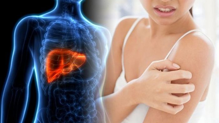 Рак печени: ранние симптомы, которые нельзя пропустить