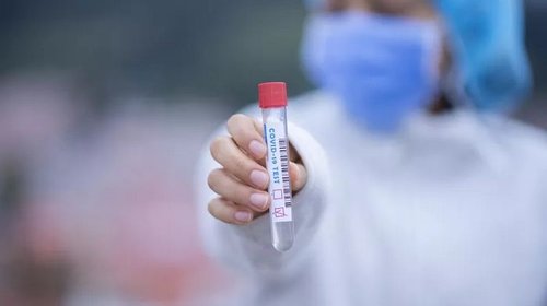 Как проводят тест на определение коронавируса в клинике?