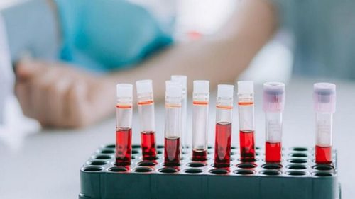 У яких випадках може знадобитися загальний аналіз крові?