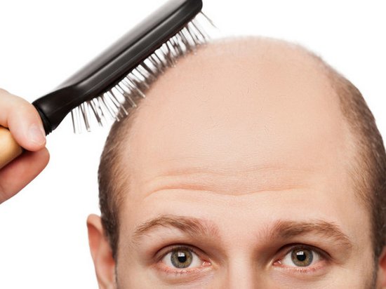 Эффективен ли «Миноксидил» от выпадения волос?