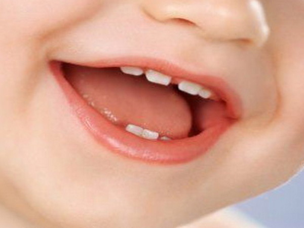Кариес молочных зубов