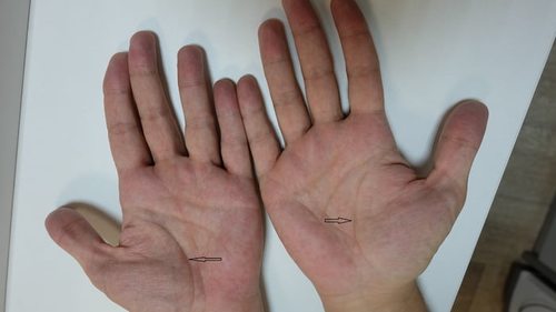 Читаем по ладоням. Можно ли диагностировать болезни по рукам?