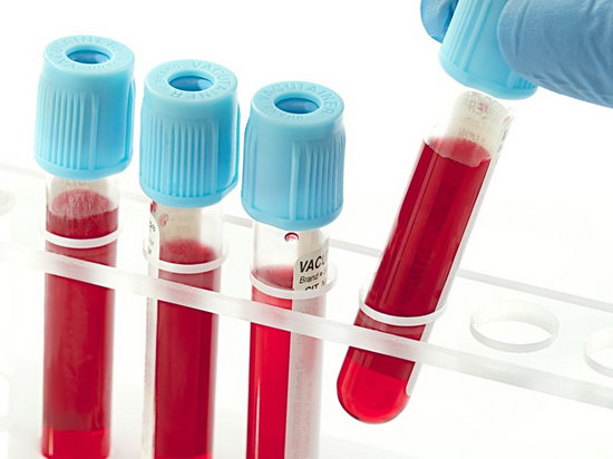 Анализ крови у женщин – показатели общего анализа крови