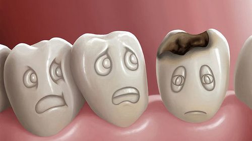 Секрет восточных мудрецов, как сохранить здоровье зубов до старости
