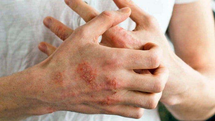 Как определить болезни по рукам?