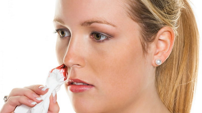 Как быстро остановить кровь из носа