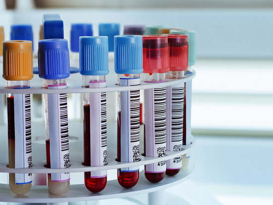 Анализ крови на билирубин – что нужно знать