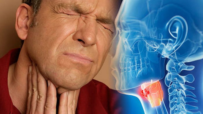 Рак горла: основные симптомы болезни