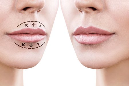 Как увеличить губы: народные методы
