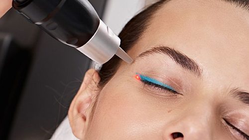 Особенности удаления перманентного макияжа посредством лазера