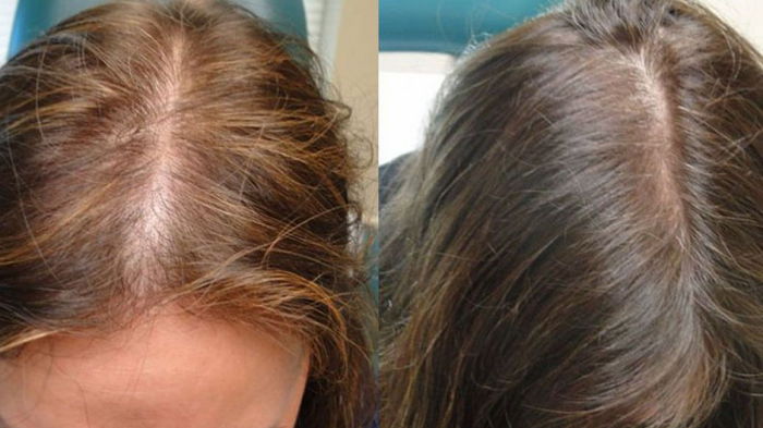 Помогут 3 ложки кофе: что нужно сделать, чтобы волосы перестали выпадать