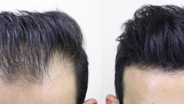 Преимущества и отличительные черты загустителей для волос Toppik