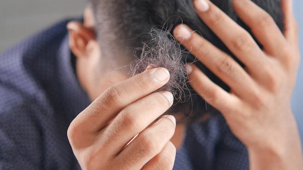 Сохранить волосы крепкими и густыми: способы лечения облысения у мужчин