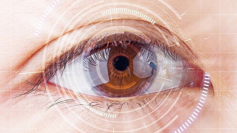 Что такое вторичная катаракта глаза