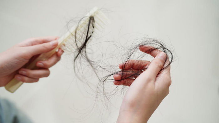 Почему выпадают волосы: неожиданные причины и когда это тревожный симптом