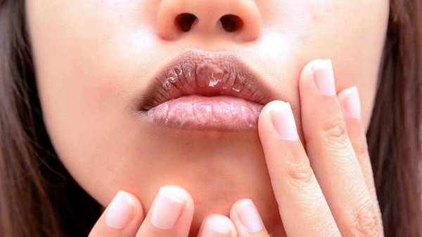 Сухость губ: 8 распространенных ошибок, которые могут усугубить проблему