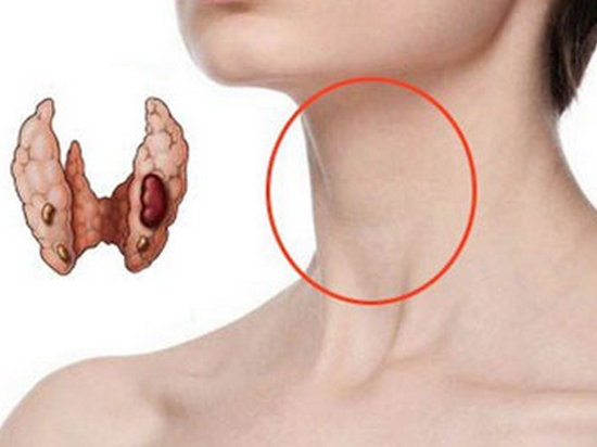Анализ крови на щитовидную железу