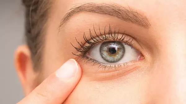 Как избавиться от морщин вокруг глаз и сохранить молодой вид кожи: 3 экспертных совета