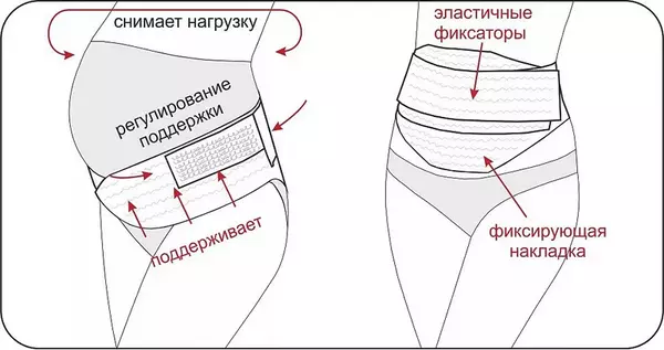 как выбрать бандаж для беременных