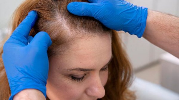 Когда при выпадении волос нужно немедленно обратиться к врачу