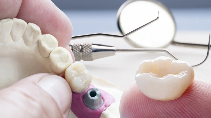 имплантация зубов