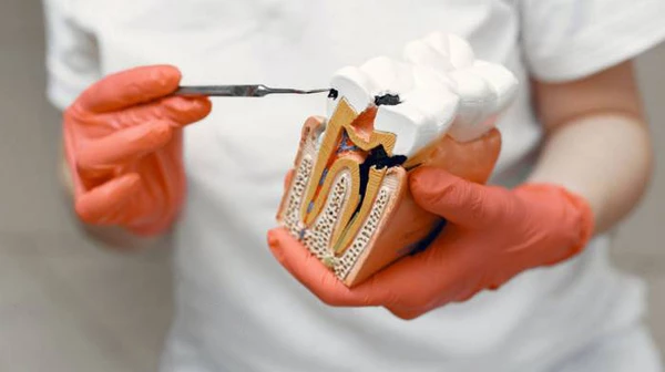 Гемисекция зуба: что это такое и как проходит операция