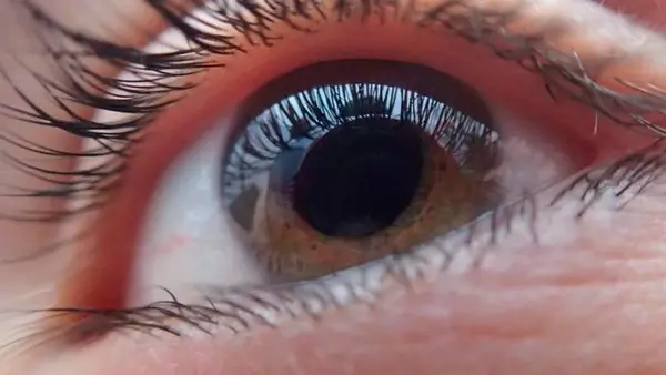 Этот популярный бьюти-тренд может стоить вам зрения: врач указал на опасность