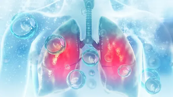 Какая пища разрушает легкие: эти продукты необходимо исключить из своего рациона