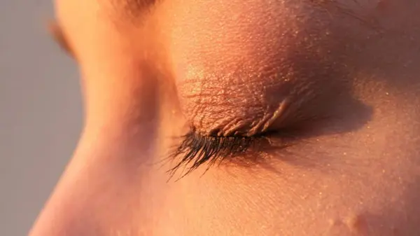 Сухость век: почему она возникает и как с этим бороться