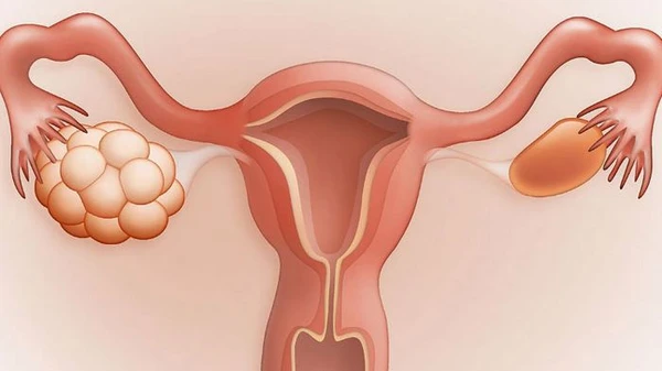Нормалізація функції яєчніків: основні способи