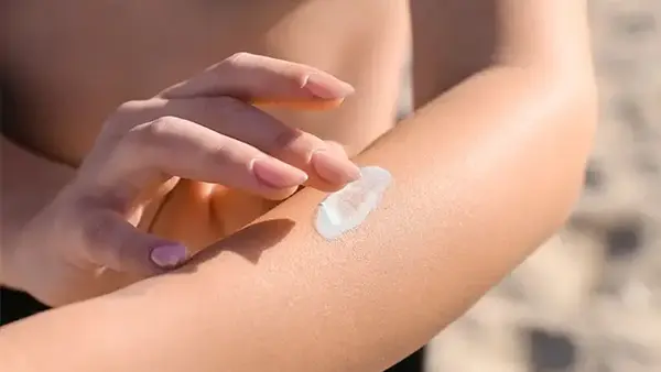 Три проверенных способа быстро облегчить боль, если вы обгорели на солнце