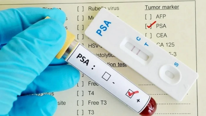 Сироваткові біомаркери та рідинна біопсія