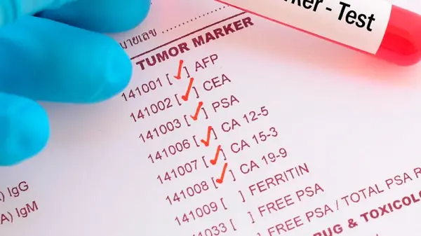 Які онкомаркери використовують при саркомі: сучасний діагностичний підхід
